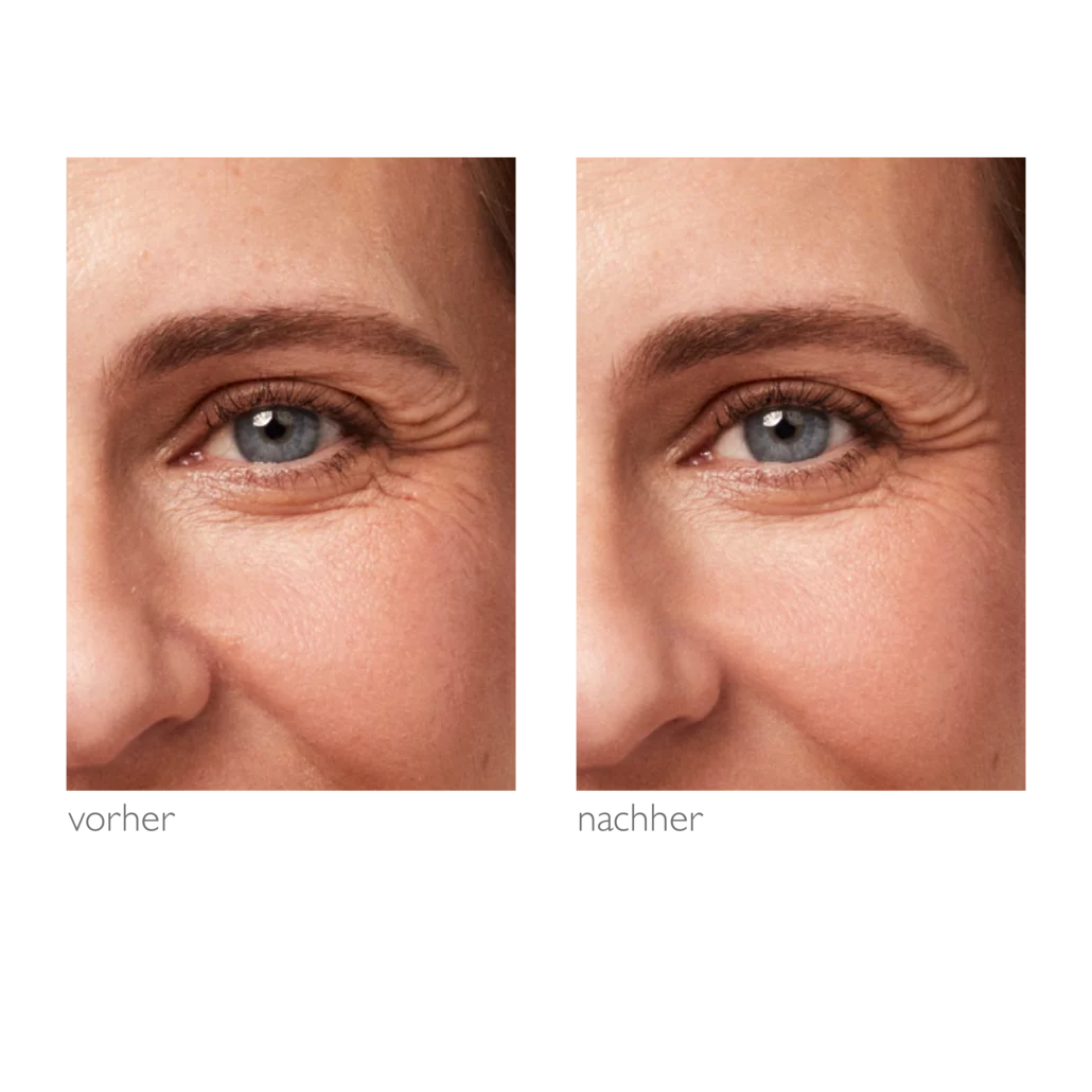 Alcina- Rosé Effect Oogcrème